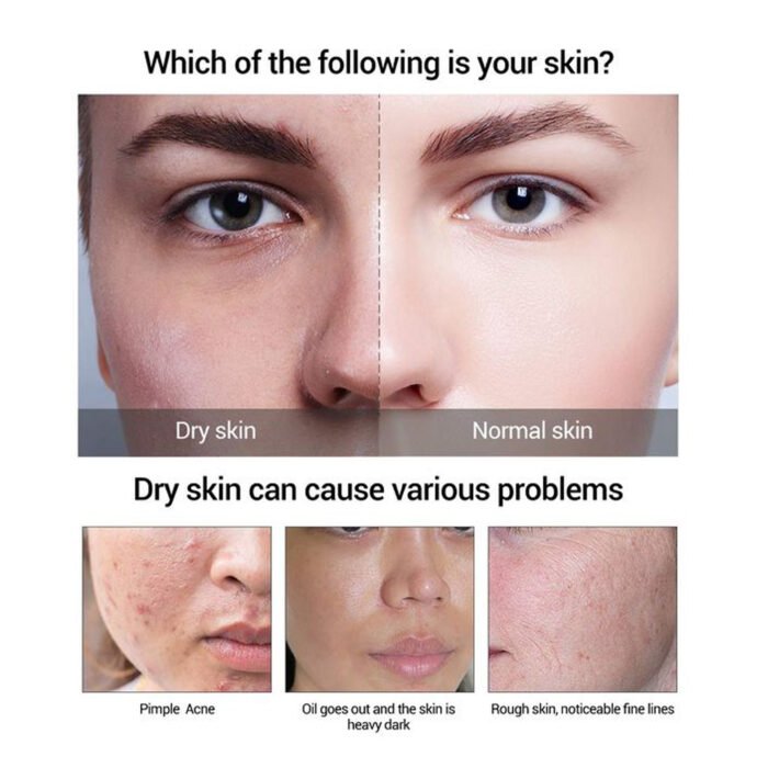 DR.DAVEY VC NICOTINAMIDE BODY LOTION Nourishing Exfoliator Lightening - Image 4