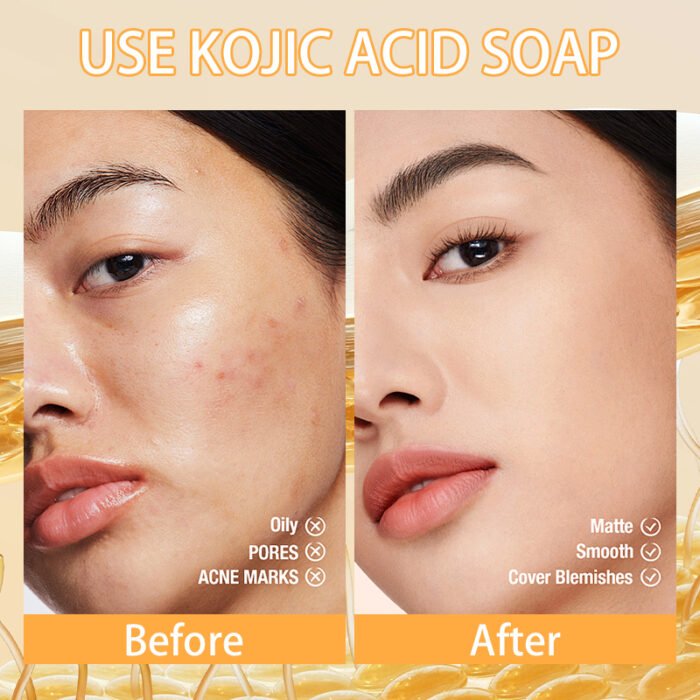 ROUSHUN Super Whitening Soap Brigtening Cleaning Body Soap Wholesale - Image 3
