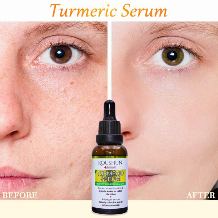 ROUSHUN Brightening Turmeric Face Serum Dark Spot Turmeric Serum - Image 3