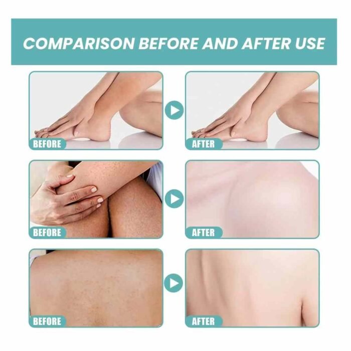 ROUSHUN Ferulic Acid Body Treatment Cream Medix 5.5 Retinol Body Lotion Firming Moisturizer - Image 4