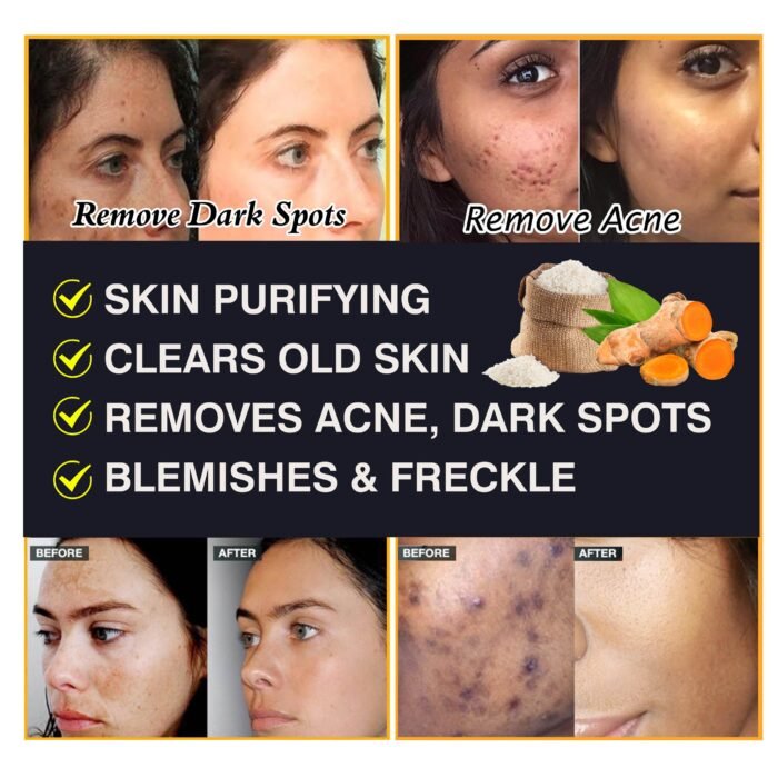 DR.DAVEY OEM ODM Double Whitening Cleansing Rice Soap Remove Dark Spot Blemishes Freckle Facial Soap - Image 5