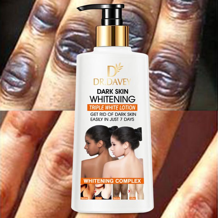 DR.DAVEY Fast Skin Whitening Body Lotion For Hand or Face Moisturizing Body Cream - Image 7